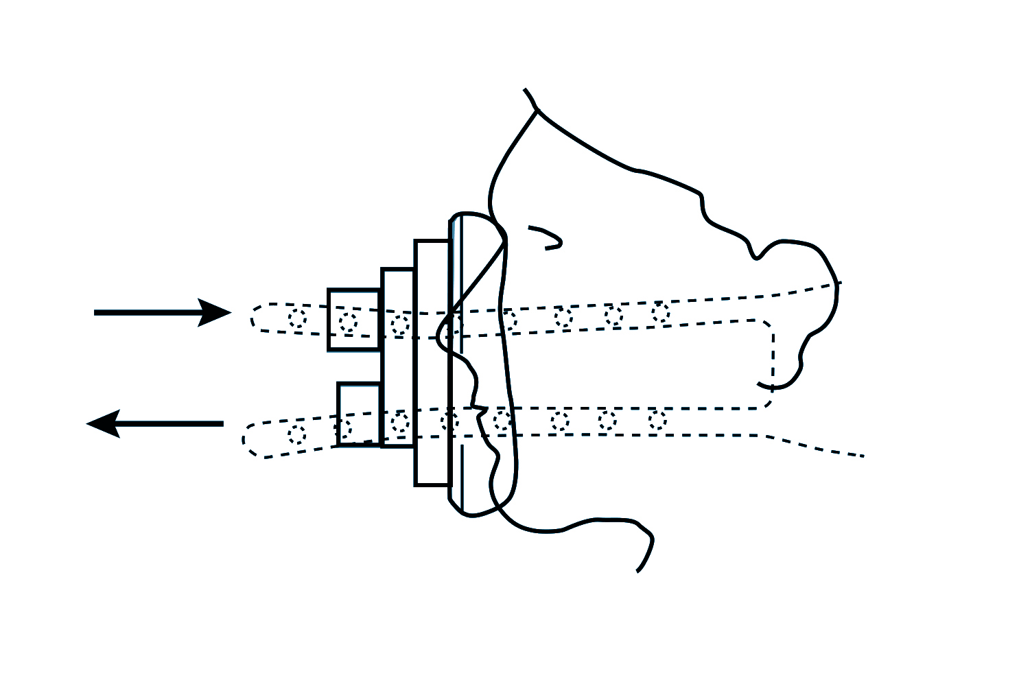 IHHT Soft Maske mit Luftkissen, Doppelport Gr. 3 mit integrierten Ventilen